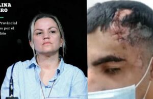 Así quedó uno de los jóvenes embestidos por Carolina Píparo